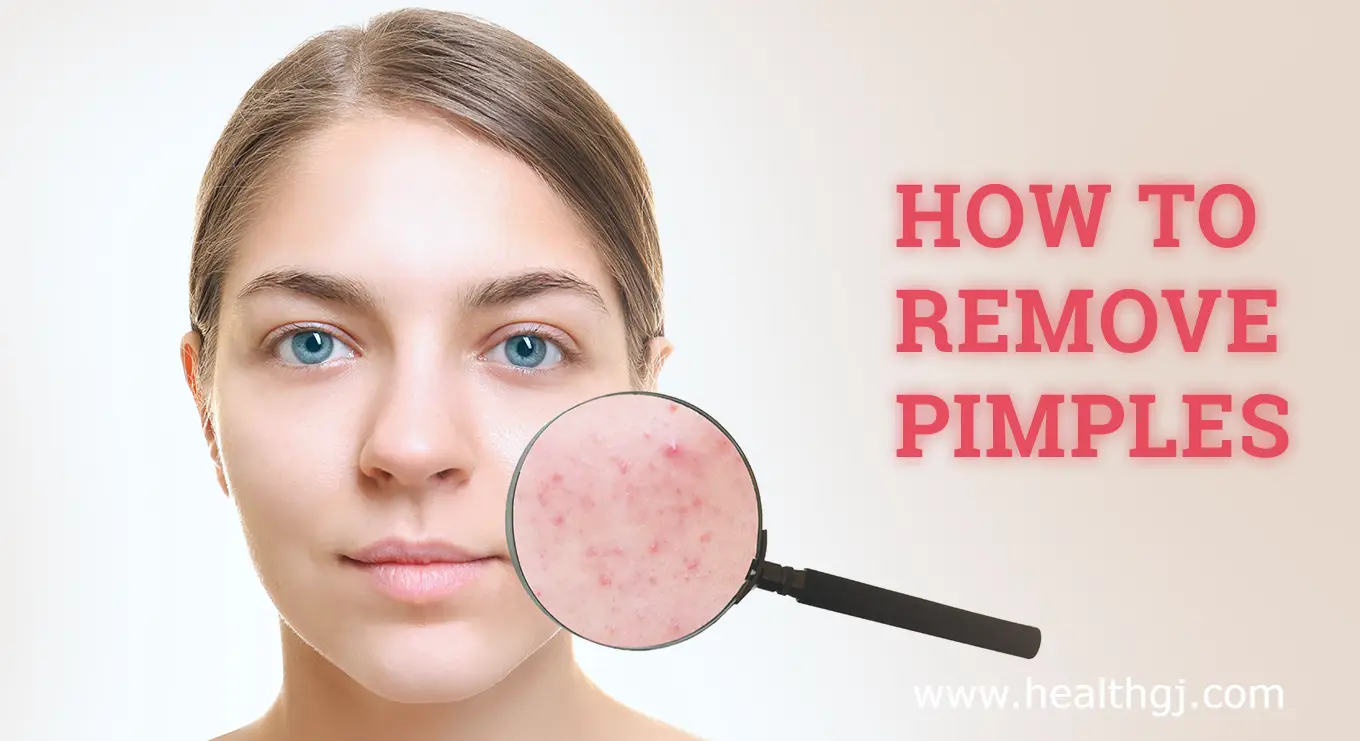 remove pimples